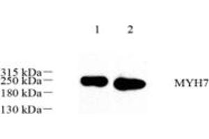 Western blot analysis of MYH7 (ABIN7075622),at dilution of 1: 500,Lane 1: Mouse heart tissue lysate,Lane 2: Rat muscle tissue lysate (Slow Skeletal Myosin Heavy Chain anticorps)