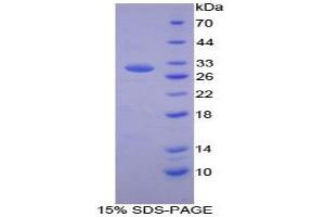 SDS-PAGE analysis of Mouse Kallikrein 5 Protein.