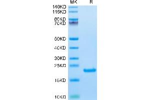Interleukin 21 (IL21) (AA 32-162) protein (His-Avi Tag,Biotin)
