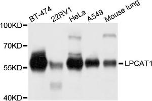 Western blot analysis of extracts of various cell lines, using LPCAT1 antibody. (LPCAT1 anticorps)