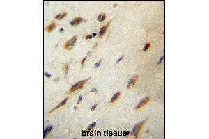 CCD Antibody (C-term) (ABIN657166 and ABIN2846300) immunohistochemistry analysis in formalin fixed and paraffin embedded human brain tissue followed by peroxidase conjugation of the secondary antibody and DAB staining.