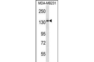PIK3R4 Antibody (Center) (ABIN657232 and ABIN2837913) western blot analysis in MDA-M cell line lysates (35 μg/lane). (PIK3R4 anticorps  (AA 819-847))