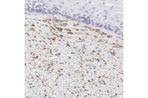 Immunohistochemical staining of human esophagus with SPARC polyclonal antibody  shows distinct positivity in fibroblasts. (SPARC anticorps)