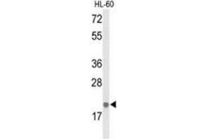 Western blot analysis of IL26  (arrow) in HL-60 cell line lysates (35ug/lane) using Interleukin-26 / IL26  (IL-26 anticorps  (Middle Region))