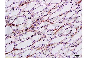 Formalin-fixed and paraffin embedded rat kidney tissue labeled with Anti-ENaCg/?