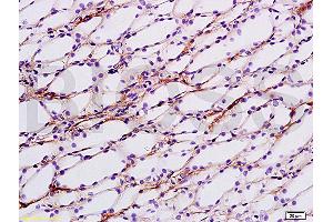 Formalin-fixed and paraffin embedded rat kidney tissue labeled with Anti-ENaCg/? (SCNN1G anticorps  (AA 188-290))