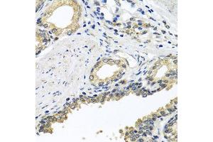 Immunohistochemistry of paraffin-embedded human prostate using STXBP2 antibody at dilution of 1:100 (x40 lens). (STXBP2 anticorps)