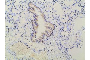 ABIN6277691 at 1/100 staining mouse lung tissue sections by IHC-P. (Ephrin B2 anticorps  (C-Term))