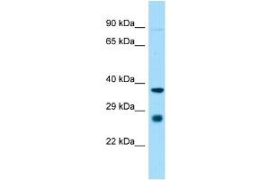 Host:  Rabbit  Target Name:  St8sia1  Sample Type:  Rat Heart lysates  Antibody Dilution:  1.