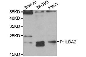 Western Blotting (WB) image for anti-Pleckstrin Homology-Like Domain, Family A, Member 2 (PHLDA2) antibody (ABIN1882371) (PHLDA2 anticorps)