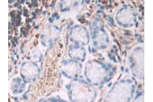 Detection of FLNa in Human Stomach Tissue using Polyclonal Antibody to Filamin A Alpha (FLNa)