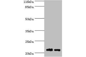 Western blot All lanes: NABP1 antibody at 2 μg/mL Lane 1: Hela whole cell lysate Lane 2: Jurkat whole cell lysate Secondary Goat polyclonal to rabbit IgG at 1/10000 dilution Predicted band size: 23, 14, 15 kDa Observed band size: 23 kDa (OBFC2A anticorps  (AA 1-204))