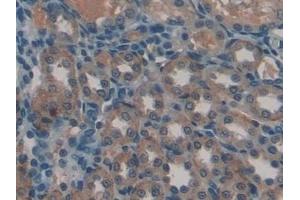 Detection of GREM1 in Human Kidney Tissue using Polyclonal Antibody to Gremlin 1 (GREM1)
