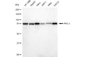 Western blotting analysis using PKC alpha antibody (ABIN7799989).