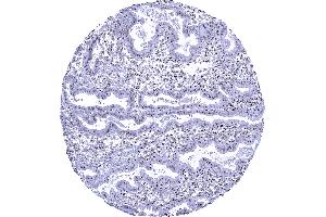 Uterus endometrium In this sample of endometrium nucleolin staining is particularly prominent in the nucleoli of epithelial and stromal cells