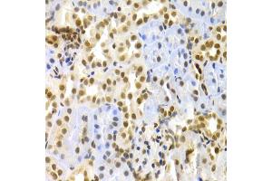Immunohistochemistry of paraffin-embedded rat kidney using MAPK3 Antibody. (ERK1 anticorps)