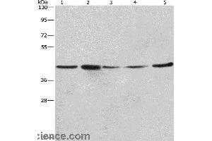 Western blot analysis of A549, NIH/3T3 and 293T cell? (RPSA/Laminin Receptor anticorps)