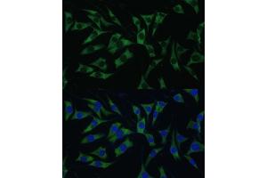 Immunofluorescence analysis of L929 cells using P Polyclonal Antibody (ABIN7269446) at dilution of 1:100 (40x lens).