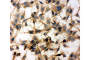 Anti-MTCO1 antibody,  ICC ICC: C6 Cell