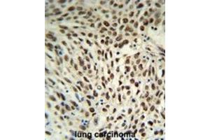 Immunohistochemistry (IHC) image for anti-Small Nuclear Ribonucleoprotein D3 Polypeptide 18kDa (SNRPD3) antibody (ABIN3004111) (SNRPD3 anticorps)