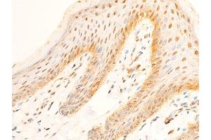 ABIN6267237 at 1/100 staining human skin tissue sections by IHC-P.