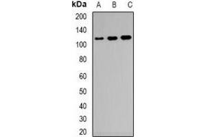 Western blot analysis of CD21 expression in Raji (A), KB (B), NIH3T3 (C) whole cell lysates. (CD21 anticorps)