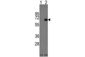 Western blot analysis of AFP antibody and 293 cell lysate either nontransfected (Lane 1) or transiently transfected with the AFP gene (2). (alpha Fetoprotein anticorps  (AA 300-329))