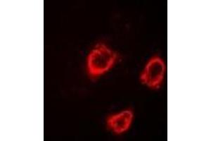 Immunofluorescent analysis of TRPV5 staining in HT29 cells.