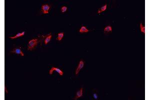 ABIN6266502 staining A-431 cells by IF/ICC.