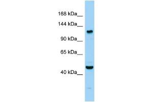 Host: Rabbit Target Name: Agtpbp1 Sample Type: Mouse Testis lysates Antibody Dilution: 1. (AGTPBP1 anticorps  (C-Term))