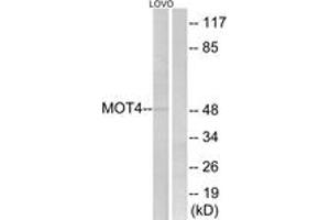 Western Blotting (WB) image for anti-Solute Carrier Family 16 (Monocarboxylic Acid Transporters), Member 3 (SLC16A3) (AA 233-282) antibody (ABIN2890421) (SLC16A3 anticorps  (AA 233-282))
