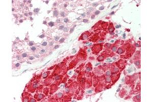 Human Testis: Formalin-fixed, paraffin embedded (FFPE) tissue.