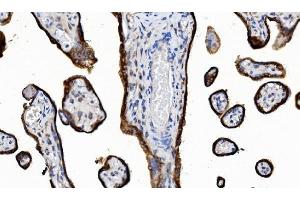 IHC analysis of POR using anti-POR antibody (ABIN7602795).