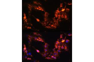 Immunofluorescence analysis of C6 cells using GRM1 Rabbit pAb  at dilution of 1:100 (40x lens). (Metabotropic Glutamate Receptor 1 anticorps  (AA 921-1010))
