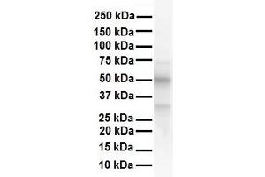 WB Suggested Anti-ESR2 antibody Titration: 1 ug/mL Sample Type: Human liver (ESR2 anticorps  (N-Term))
