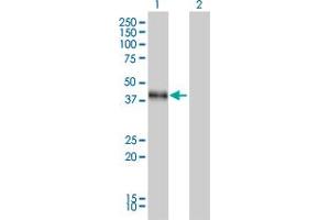 Western Blot analysis of DLX3 expression in transfected 293T cell line by DLX3 monoclonal antibody (M01), clone 4F8. (DLX3 anticorps  (AA 1-287))