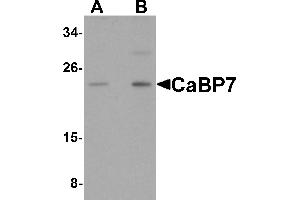 Western Blotting (WB) image for anti-Calcium Binding Protein 7 (CABP7) (N-Term) antibody (ABIN1031287) (CABP7 anticorps  (N-Term))