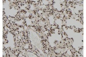 ABIN6272384 at 1/100 staining Rat lung tissue by IHC-P. (PEG3 anticorps)