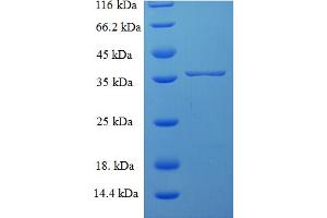 SDS-PAGE (SDS) image for Sorting Nexin 24 (SNX24) (AA 1-169), (full length) protein (His-SUMO Tag) (ABIN5710394)