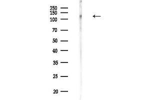 anti-Ring Finger Protein 40, E3 Ubiquitin Protein Ligase (RNF40) antibody