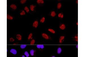 Confocal immunofluorescence analysis of U2OS cells using AKAP8 Polyclonal Antibody at dilution of 1:200. (AKAP8 anticorps)