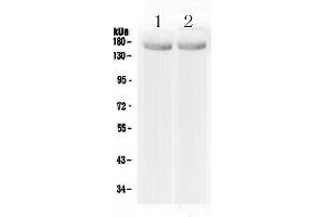 Western blot analysis of MED14 using anti-MED14 antibody . (MED14 anticorps  (AA 181-375))