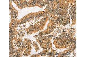 Immunohistochemistry of Human tonsil using BCL2L14 Polyclonal Antibody at dilution of 1:40 (BCL2L14 anticorps)