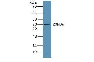 Detection of Recombinant RBP3, Rat using Polyclonal Antibody to Retinol Binding Protein 3, Interstitial (RBP3)