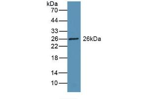 Detection of Recombinant RBP3, Rat using Polyclonal Antibody to Retinol Binding Protein 3, Interstitial (RBP3) (RBP3 anticorps  (AA 1027-1229))