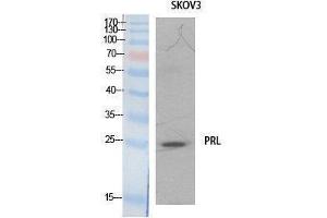 Western Blotting (WB) image for anti-Prolactin (PRL) (Internal Region) antibody (ABIN3181064)