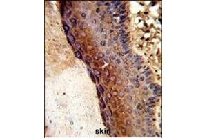 Formalin-fixed and paraffin-embedded human skin tissue reacted with GALE Antibody (Center), which was peroxidase-conjugated to the secondary antibody, followed by DAB staining.