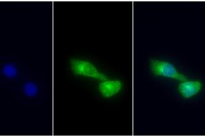 Detection of CK18 in Human Hela cell using Polyclonal Antibody to Cytokeratin 18 (CK18)