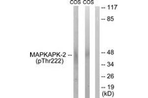 Western blot analysis of extracts from COS7 cells treated with UV 15', using MAPKAPK-2 (Phospho-Thr222) Antibody. (MAPKAP Kinase 2 anticorps  (pThr222))