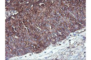 Image no. 7 for anti-phosphofructokinase, Platelet (PFKP) antibody (ABIN1500161)